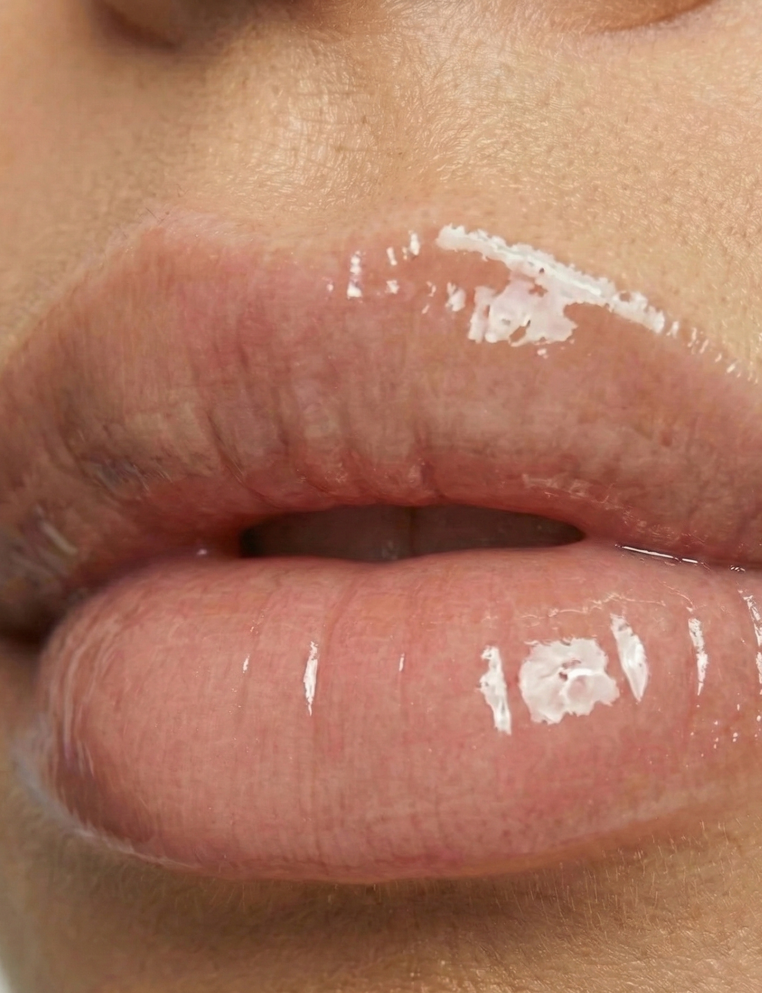 Lip Fila Silk Nubyén Nude Lip Plumping Augmentation Gloss -best safe, reversible lip plumper and a natural alternative to fillers for fuller lips.