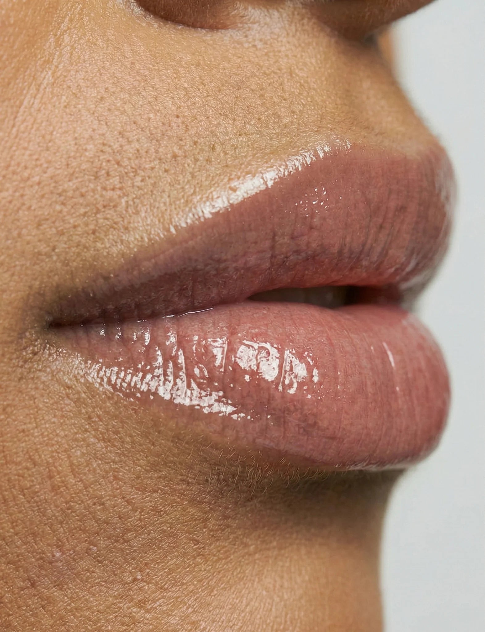 Nubyén ADAPTOGEN +++ Lip Kit | Safe, Reversible &amp; Alternative to Lip Fillers