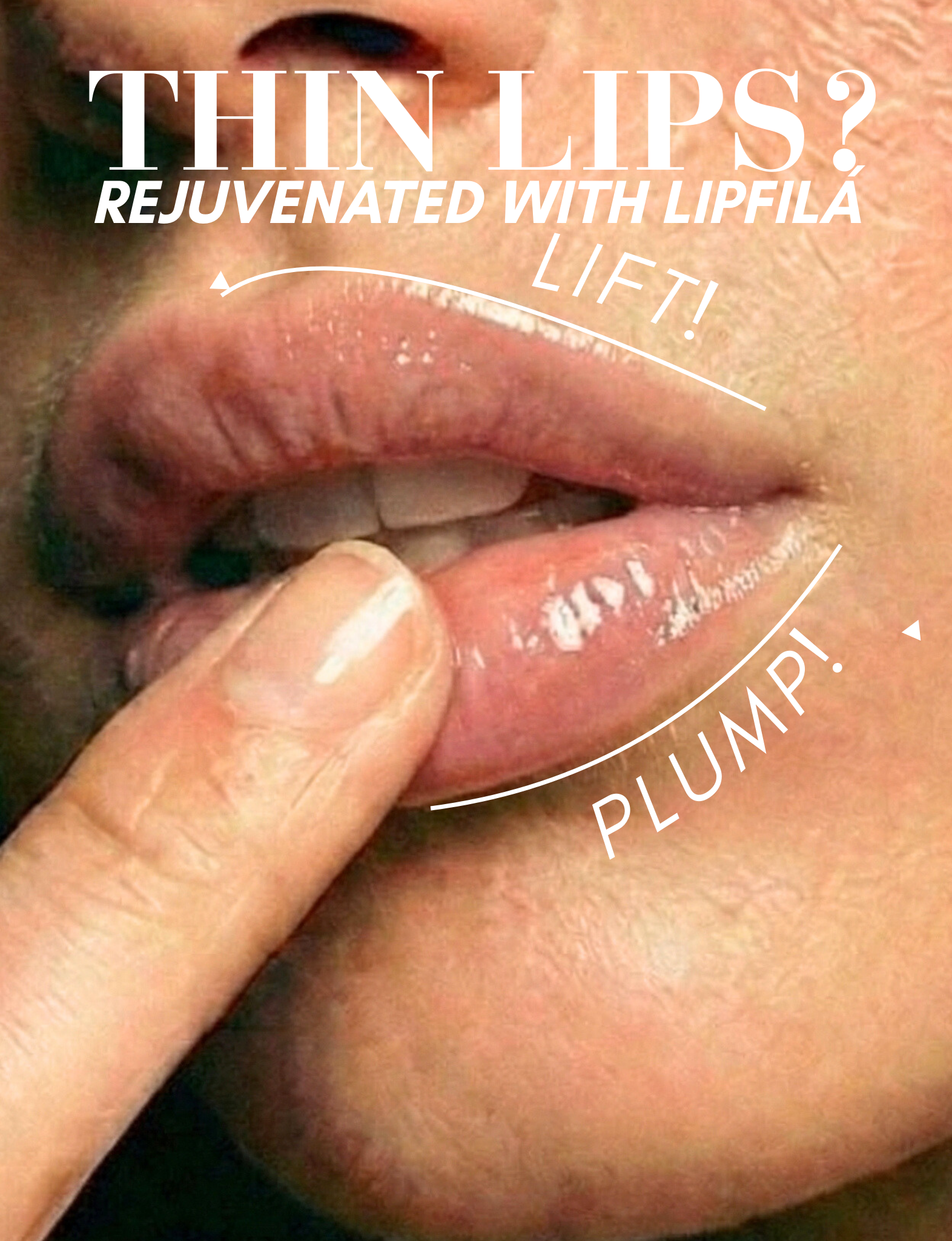 best selling Nubyen lip fila balm Nubyen Lip Fila plumping elixir balm with reishi mushroom cinnamon and lemongrass
10. Nubyen Lip Fila elixir balm vegan lip plumper safe reversible filler alternative
11. best lip plumping balm Nubyen Lip Fila elixir botanical blend non glossy finish plumps lips instantly and provides full lips instantly