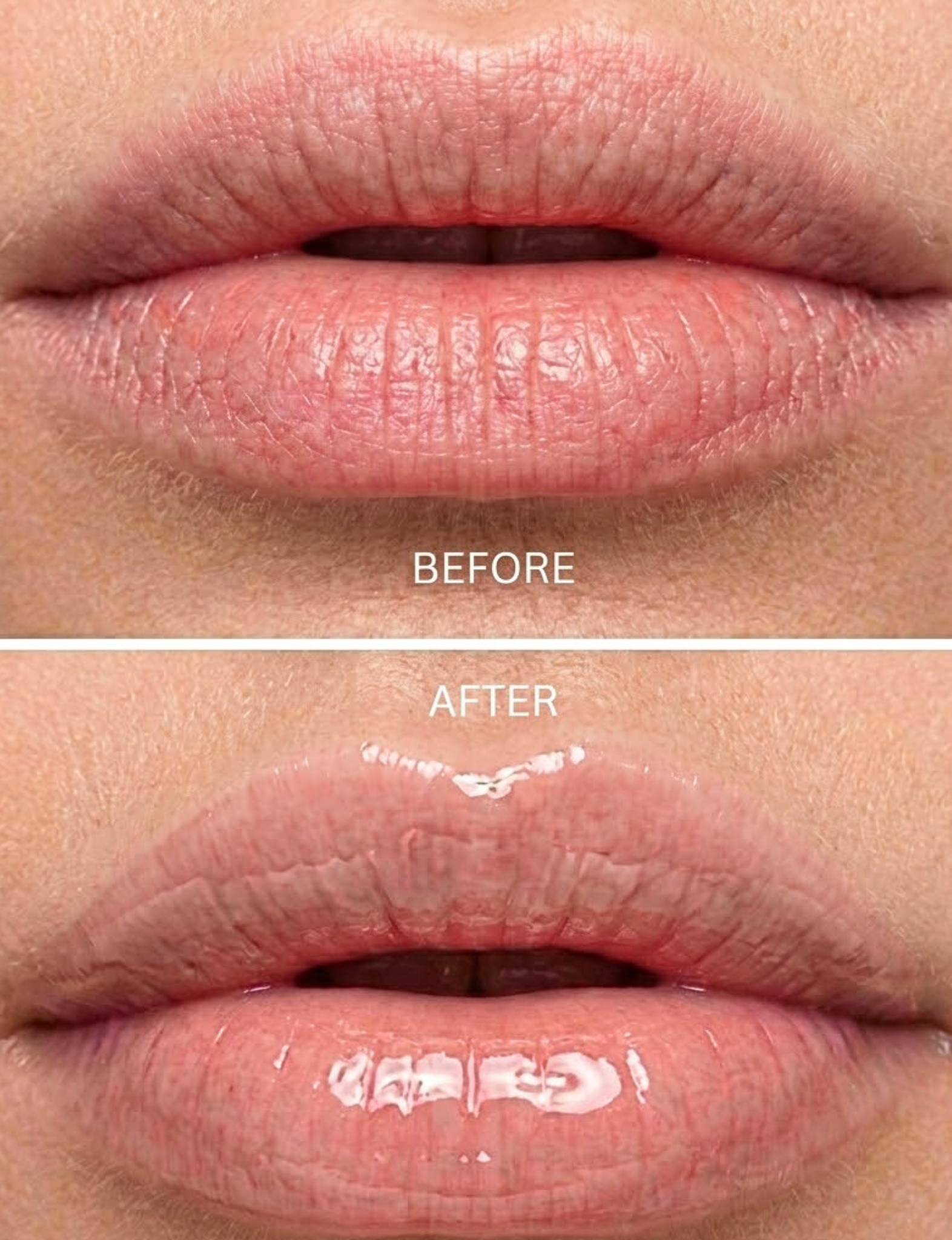 Nubyén Nude Lip Plumping Augmentation Gloss -best safe, reversible lip plumper and a natural alternative to fillers for fuller lips.Nubyen lip plumper, best lip plumper, lip plumping gloss, nubyen lip plumping balm, lip plumping balm, This Lip plumping gloss Nubyen Nude, its our best selling vegan and cruelty free gloss for fuller lips instantly, has natural ingredients such as collagen &amp; hyaluronic acid, best lip plumping lipgloss, best lip plumper, lip filler, full lips, lip injections, to faced lip