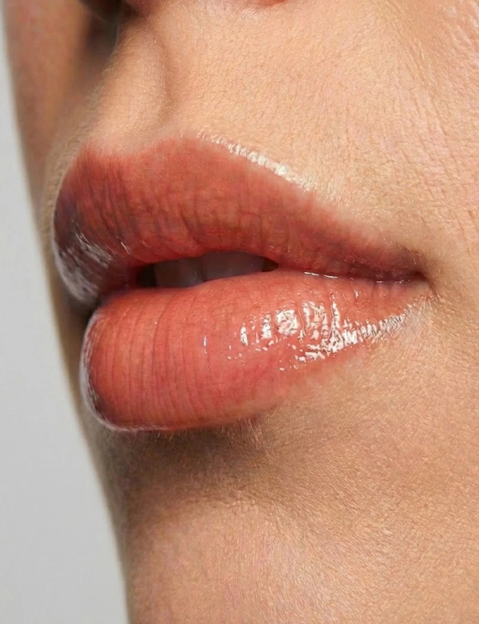 Nubyén ADAPTOGEN +++ Lip Kit | Safe, Reversible &amp; Alternative to Lip Fillers