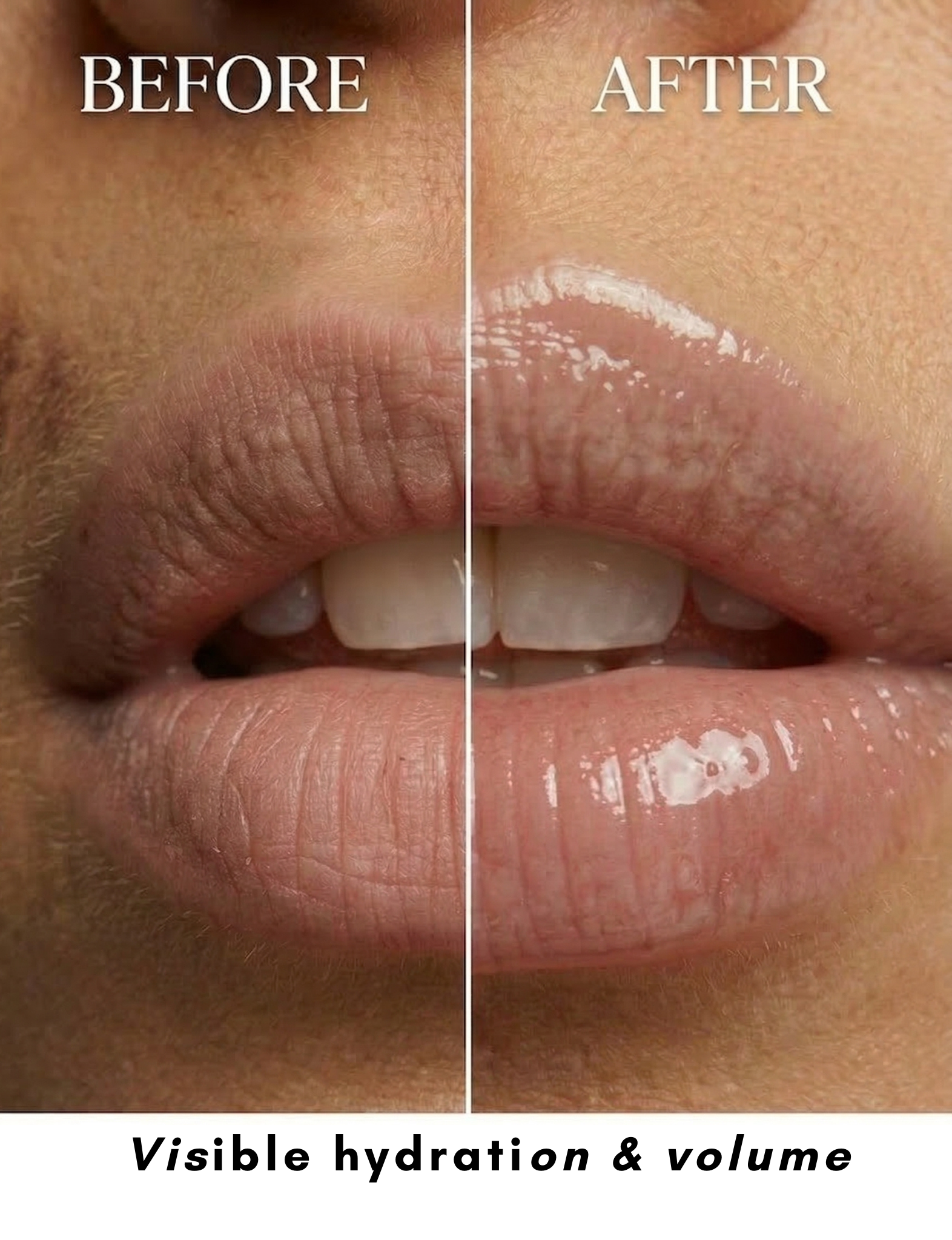 best selling Nubyen lip fila balm Nubyen Lip Fila plumping elixir balm with reishi mushroom cinnamon and lemongrass
10. Nubyen Lip Fila elixir balm vegan lip plumper safe reversible filler alternative
11. best lip plumping balm Nubyen Lip Fila elixir botanical blend non glossy finish plumps lips instantly and provides full lips instantly