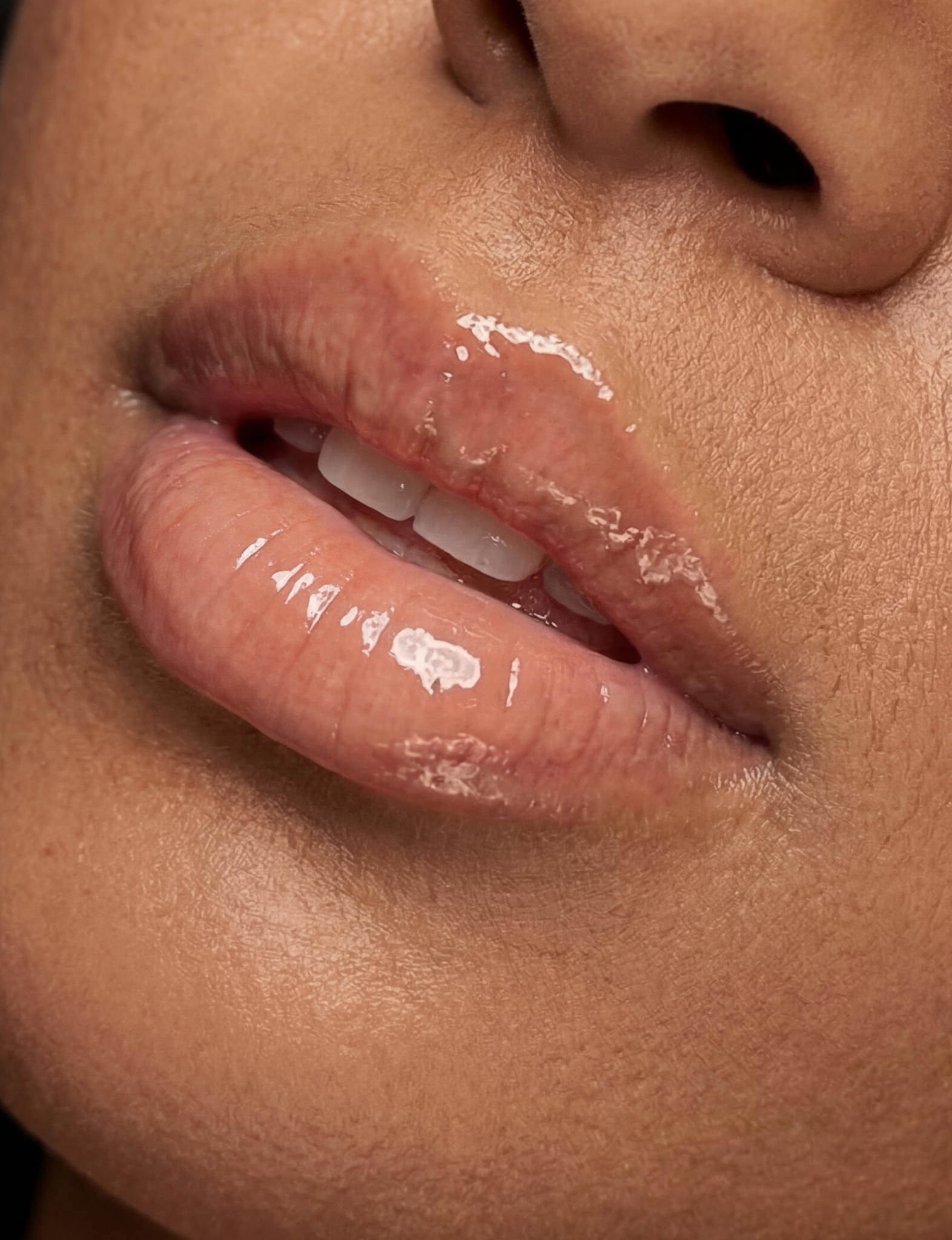 Nubyen lip plumper, best lip plumper, lip plumping gloss, nubyen lip plumping balm, lip plumping balm, This Lip plumping gloss Nubyen Nude, its our best selling vegan and cruelty free gloss for fuller lips instantly, has natural ingredients such as collagen &amp; hyaluronic acid, best lip plumping lipgloss, best lip plumper, lip filler, full lips, lip injections, to faced lip injection, nubyen nude , nubyen lip fila, nubyen lip plumping balm , lip fila, tinted lip plumping elixir, nubyen nude , refy, sephora,