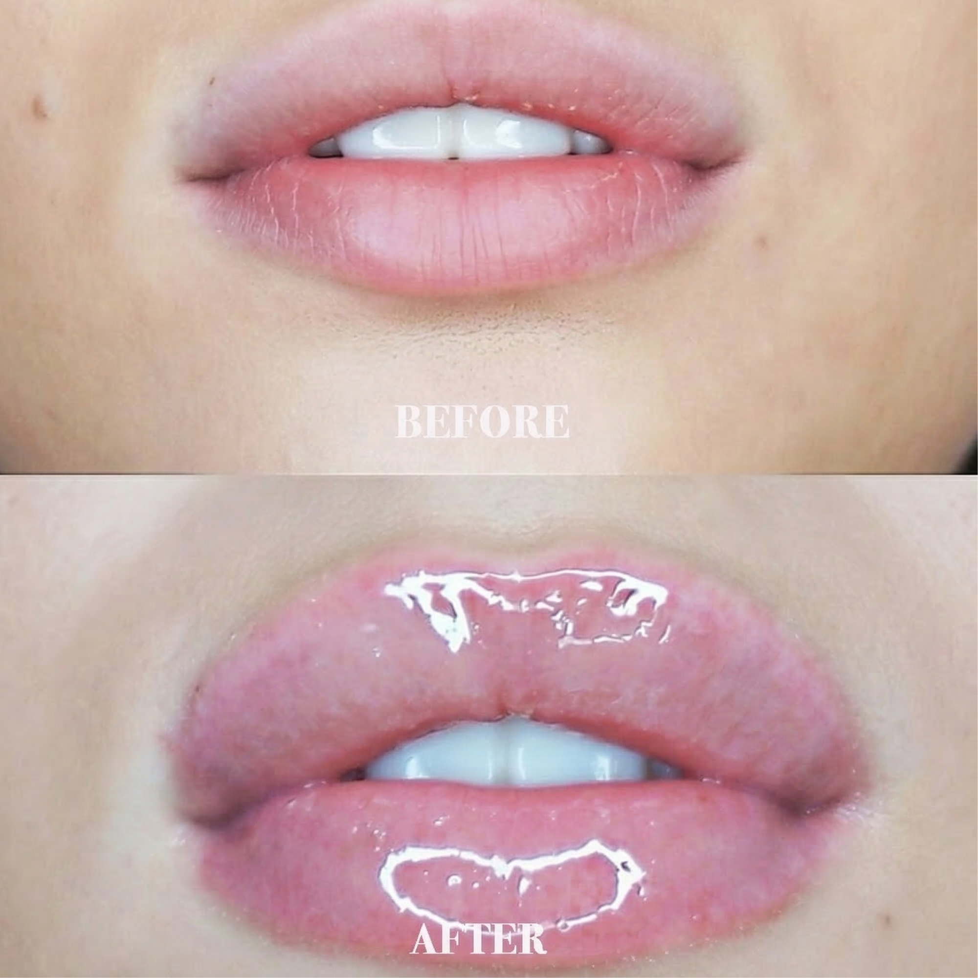 Nubyén Nude Lip Plumping Augmentation Gloss -best safe, reversible lip plumper and a natural alternative to fillers for fuller lips.